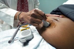 Pregnant belly ultrasound